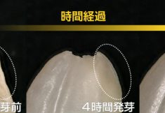 発芽玄米の簡単な作り方